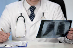 notas sobre la radiografía de pulmón